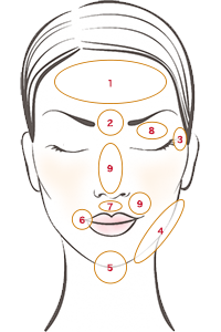 ボトックス注射施術部位