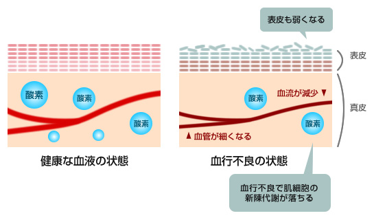 くまの原因 青ぐま